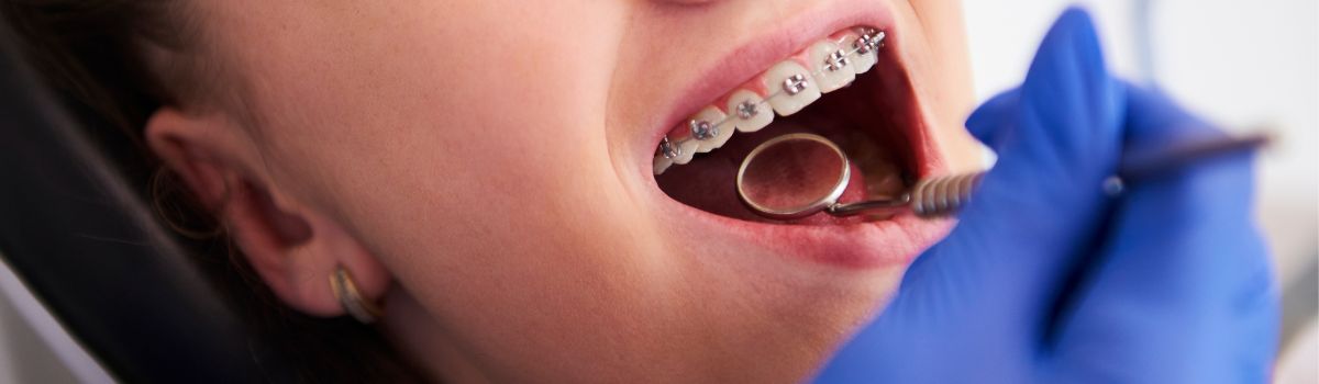 Fille chez dentiste pour contrôle