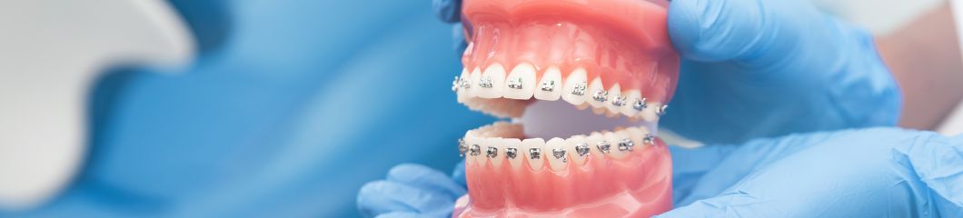 Helan Dentalia Up Tandverzekering Orthodontie 