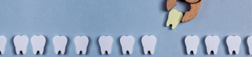 Tand los, afgebroken of beschadigd: wat te doen bij een tandongeval?